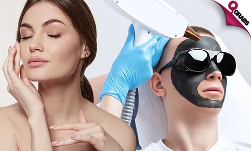 Carbon Laser Peel Treatments!
